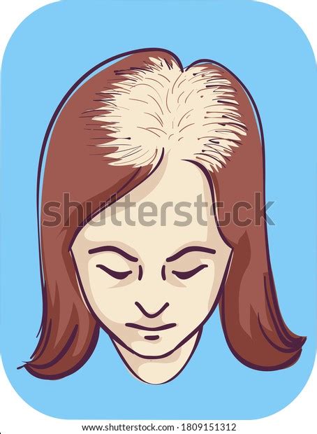 Illustration Girl Female Pattern Baldness Thinning Stock Vector