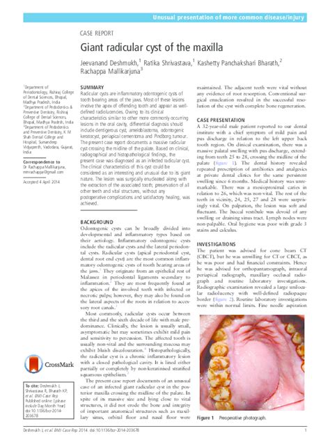 pdf giant radicular cyst of the maxilla amelia tiro