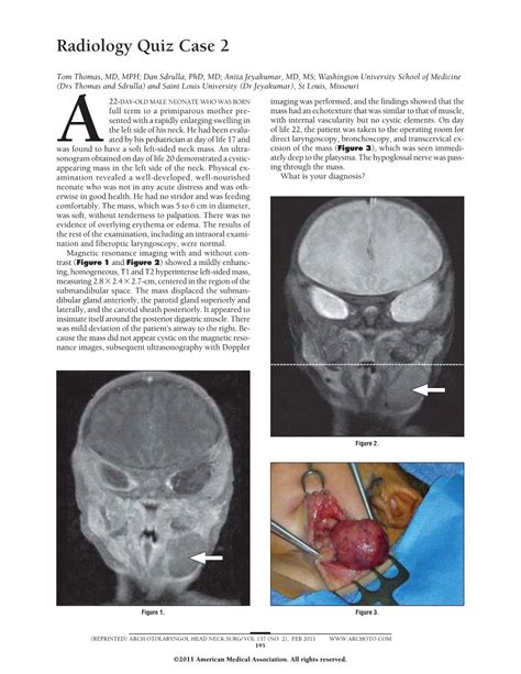 Radiology Quiz Case 2 Jama Otolaryngologyhead And Neck Surgery Jama Network