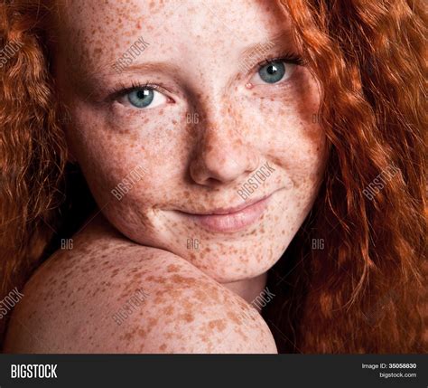 Cheerful Freckled Girl Image Photo Free Trial Bigstock