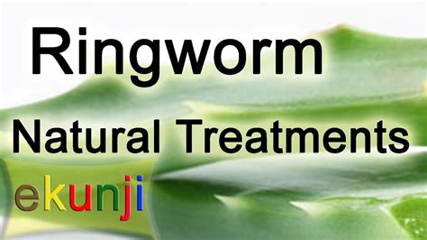 Easy Ringworm Treatment At Home Ringworm A Fungal Infection Of Skin
