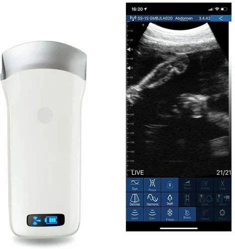 Sonostar Medical Portable Wifi Wireless Ultrasound Scanner Machine