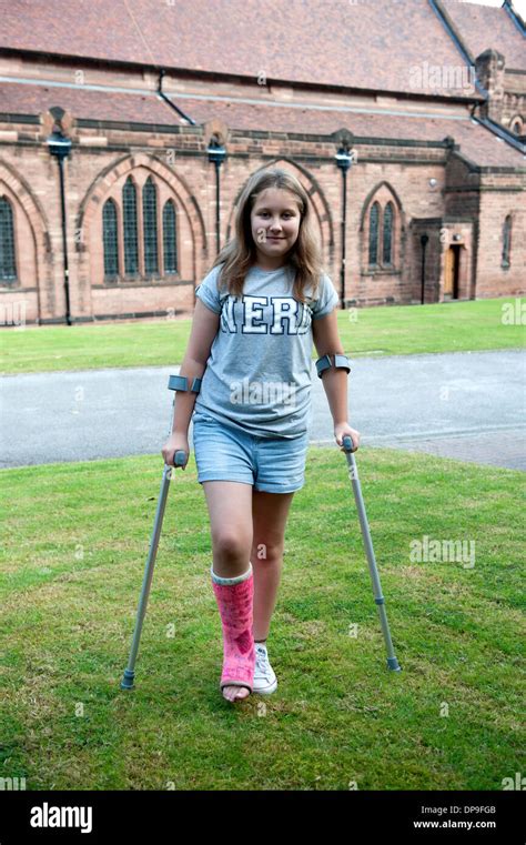 Teenage Girl On Crutches Broken Leg Plaster Pink Fully Model Released