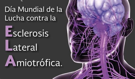 sintomas de esclerosis lateral amiotrófica esclerosis lateral amiotrófica a projeção lateral