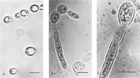 Microscopic Appearance Of Candida Albicans A Cells From Stationary