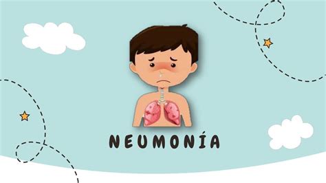 NeumonÍa En PediatrÍa GuÍa Minsa 2019 Neumonía Paciente