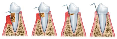 Simple Science: How to Make a Volcano with Kids