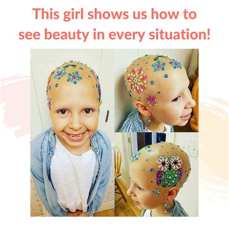 Meet Gianessa A Beautiful And Brave 7 Year Old Girl Battling Alopecia