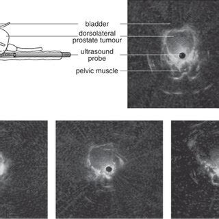 Transrectal Ultrasonography To Monitor Orthotopic Tumour Growth In The