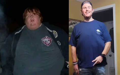Casey King 400 Pound Weight Loss Story Before And After 2022