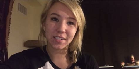 Youtuber Kalel Kitten Bravely Reveals Acne Struggle To Show Fans Shes