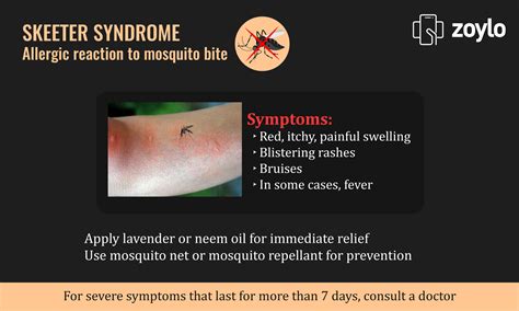 Pictures Of Allergic Reaction To Mosquito Bites Peepsburghcom