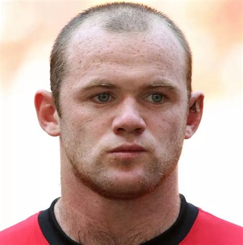 Hair Expert Reveals Wayne Rooney Should Ditch Burgers And Sex If He Wants A Full Head Of Hair