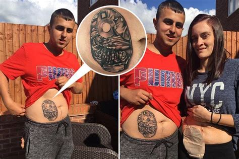 Husband Gets Tattoo Of His Wifes Stoma Bag After She Was Forced To