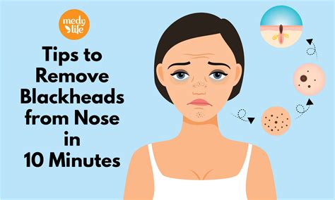 Tips to Remove Blackheads from Nose in 10 Minutes - Medy Life