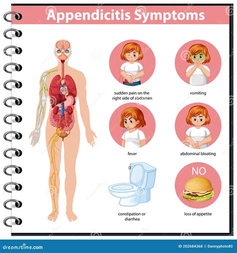 Appendicitis Symptoms Information Infographic Stock Vector Fe5