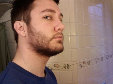 THREAD CLOSED - Rogaine Experiment in Beard Product ...