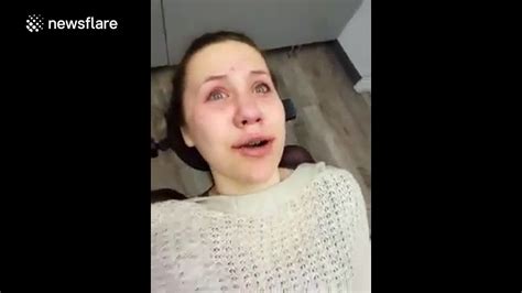 Girl Wakes Up From Operation And Thinks Shes Kylie Jenner Video