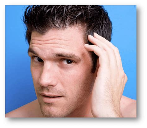 Having trouble styling your hair, by the way, is another common sign of hair loss. More info on how to deal with hair loss - Endhairloss.eu
