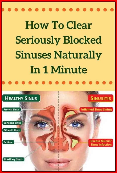 Natural Home Remedies To Clear Your Sinuses Health Tips Sinusitis
