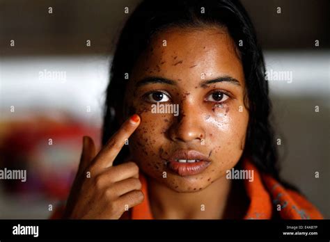 Kustia Bangladesh 7th July 2014 A 18 Year Old Girl Sonia Akter