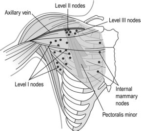 The Axilla Current Management Including Sentinel Node And Lymphoedema