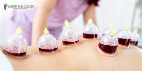 Cupping Therapy Definition Uses Types Benefits Side Effects