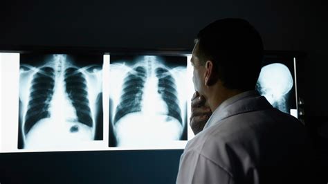 Radiologie Définition Comment Se Passe Un Examen Et Y A T Il Des