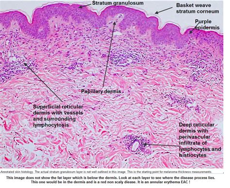 Dermpath Made Simple Neoplastic Introduction