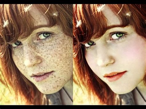 Get Rid Of Freckles Fast Subliminals Frequencies Hypnosis