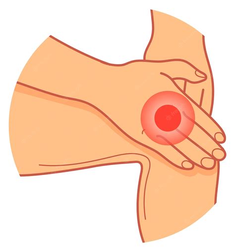 cliparts leg injury - Clip Art Library