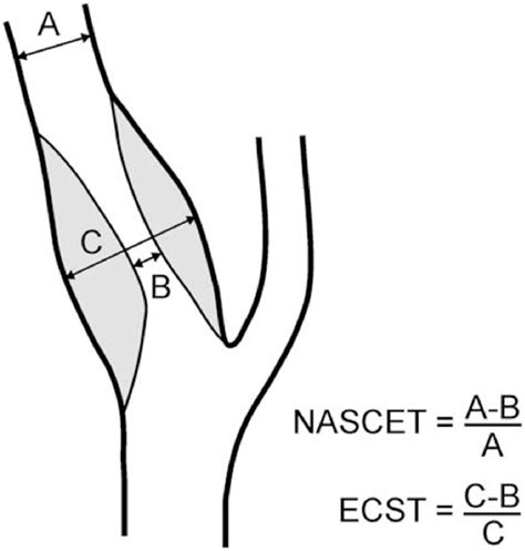 Figure From A Beginners Guide To Grading Of Carotid Artery Stenosis