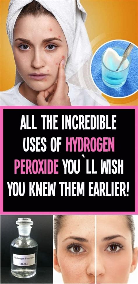 all the unbelievable uses of hydrogen peroxide you re going to want to know them before