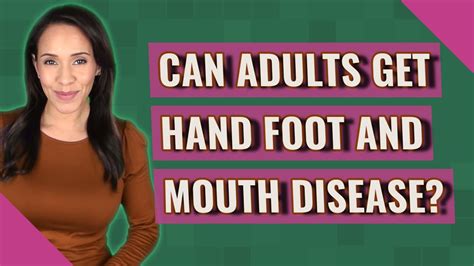 Can Adults Get Hand Foot And Mouth Disease YouTube
