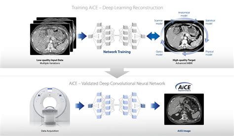 Deep Learning Reconstruction Computed Tomography Ct Scanners