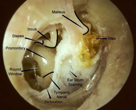 Ear Anatomy Images Mcgovern Medical School Ear Anatomy Middle Ear