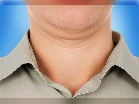What Are The Ways To Reduce Neck Fat Rs Neck Fat गर्दन के फैट को