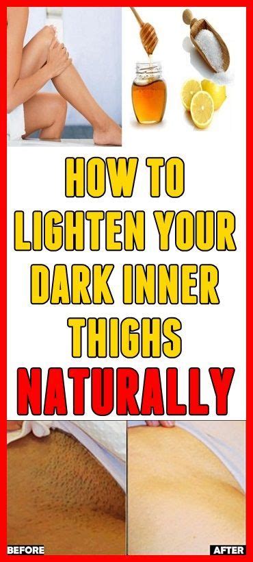 How To Lighten Your Dark Inner Thighs Naturally Darkskin Naturalremedies Inner Thigh Thighs