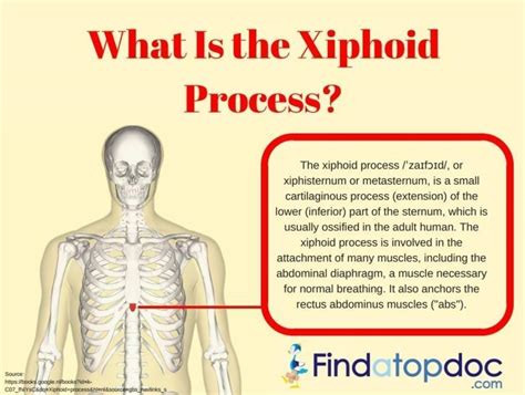 Xiphoid Process Lump In Adults