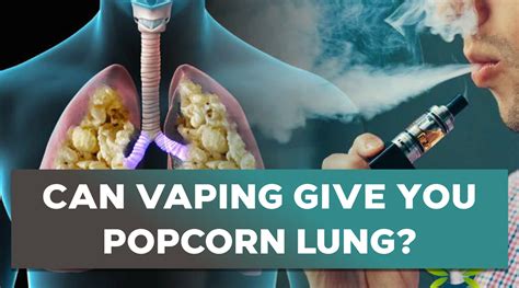 can vaping give you popcorn lung