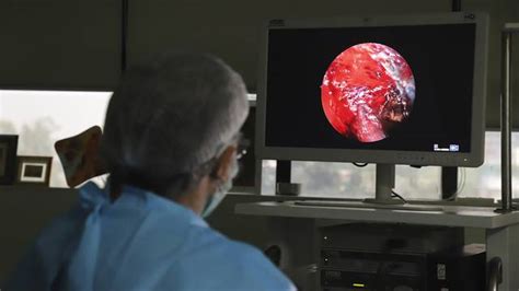 Según informó el diario el país de 26 millones de casos de coronavirus en india, 9.000 padecen esta infección posterior. Hallan en Edomex primer caso de hongo negro asociado a ...