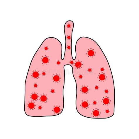 Sick Lungs With Covid 19 Coronavirus Virus Cells In Lung Infected