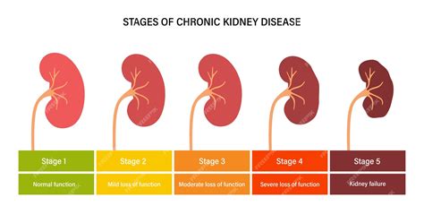 Premium Vector Kidney Disease Concept
