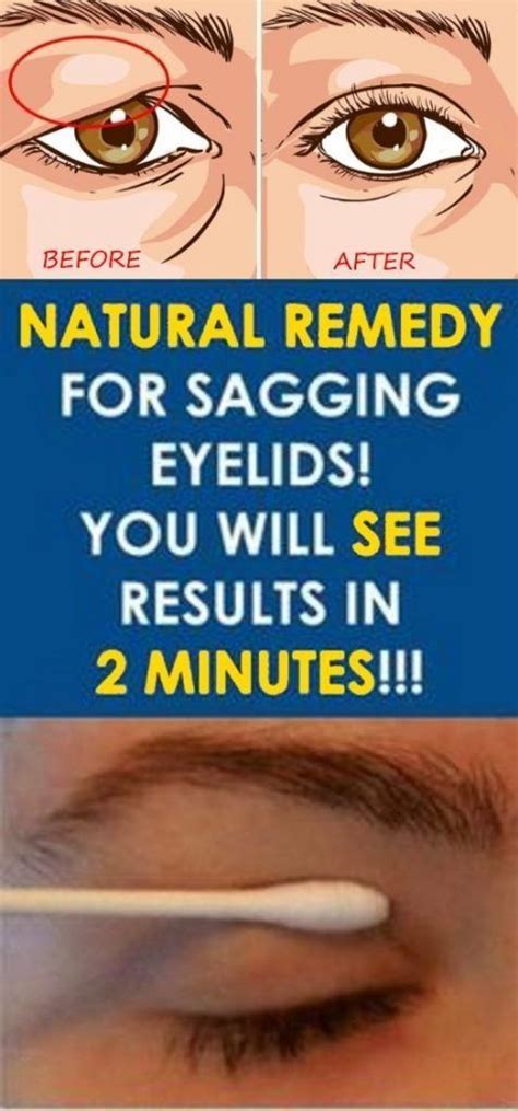 Natural Remedy For Sagging Eyelids You Will See Results In 120 Sec