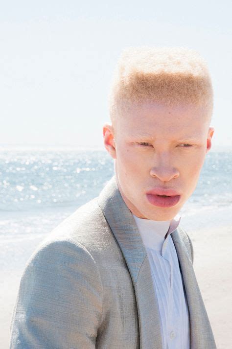 Beautiful Albino Ideas Albino Albinism Beautiful