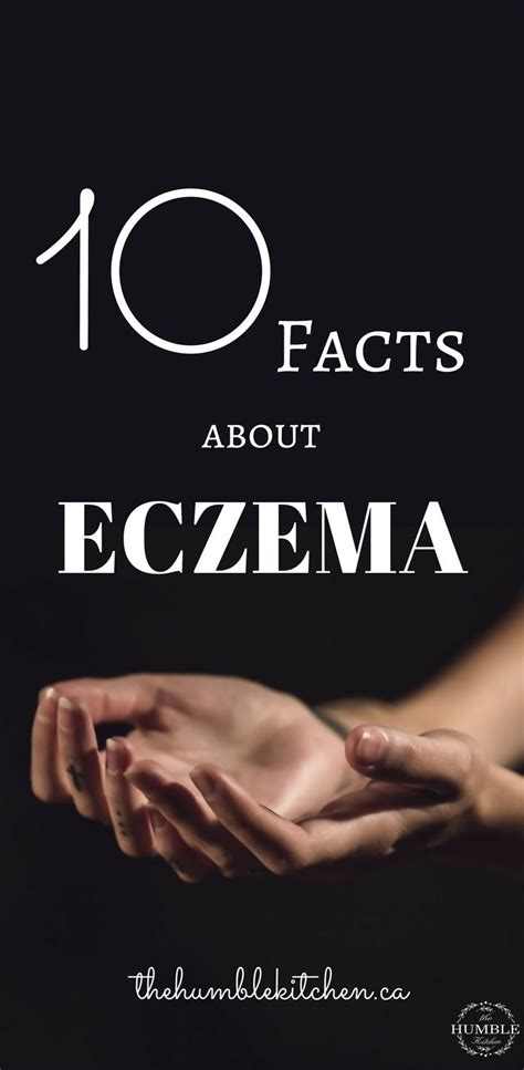 10 Facts About Eczema Eczema Remedies Facts Sagging Skin