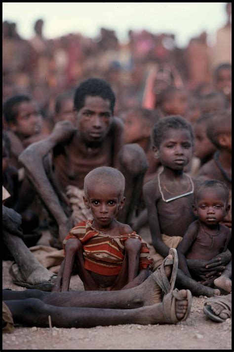 Criança Que Passa Fome Na áfrica