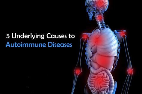 5 Underlying Causes To Autoimmune Disease