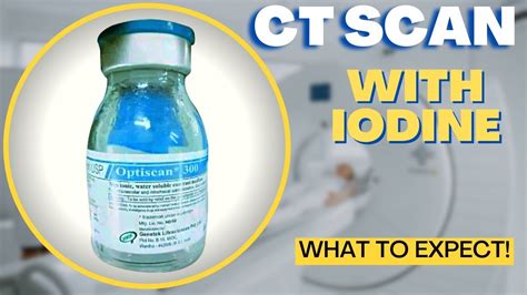 Ct Scan With Iodine Contrast What To Expect Youtube