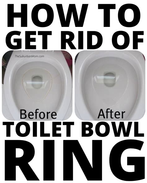 How To Get Rid Of Stubborn Toilet Bowl Ring In 2020 Toilet Bowl Ring